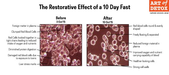 Parasite Free Detox