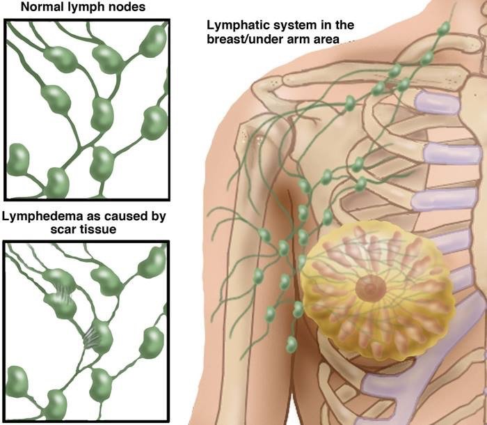 Lymphatic System